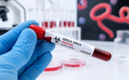 Kenya confirms second ebola case as health authorities intensify surveillance
